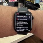 5 cara untuk mengoptimalkan Apple Watch untuk mendukung kesehatan jantung, apakah Anda?