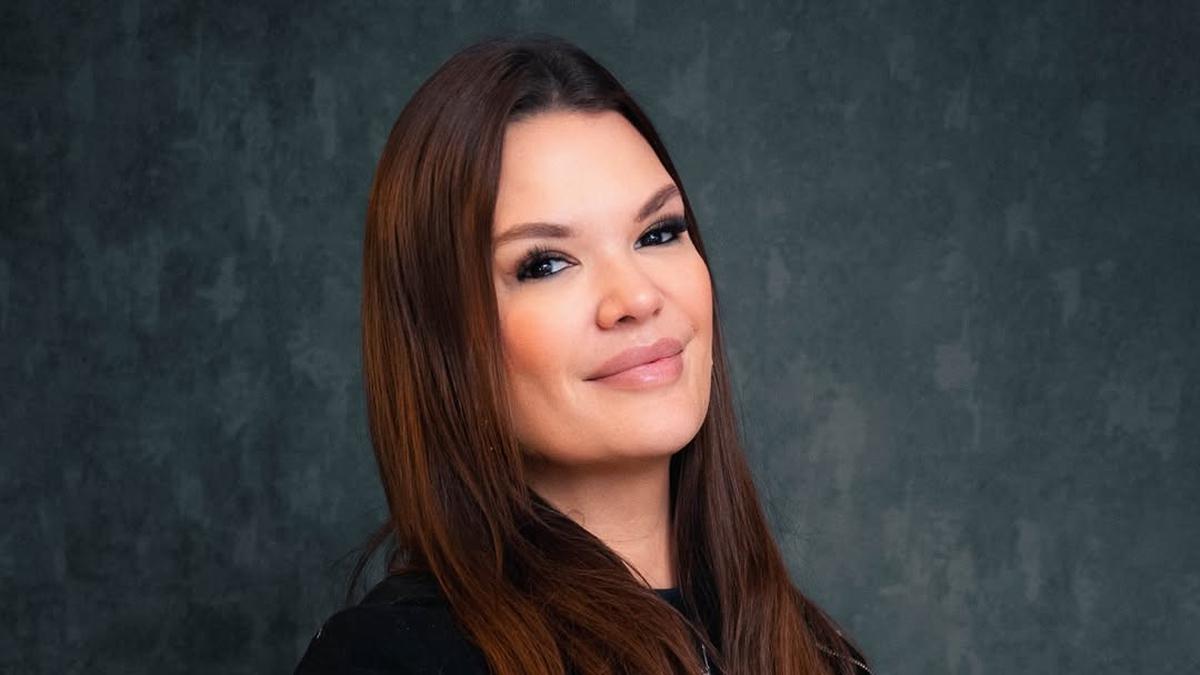 Influencer Brasil meninggal di meja bedah saat hidup 3 prosedur operasi plastik
